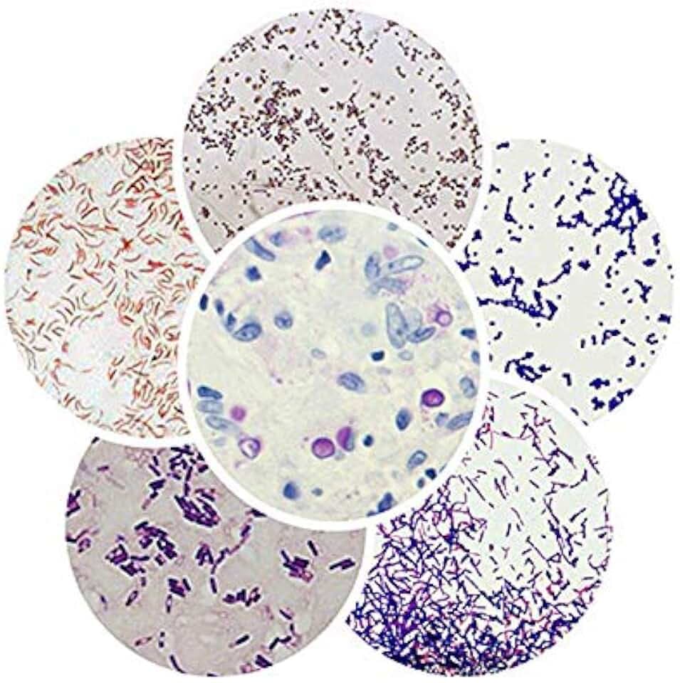 50-Set Prepared Typical Microbiology Sample Gram Stain Human Medicine Veterinary Microscope Slides for Medical Education Study