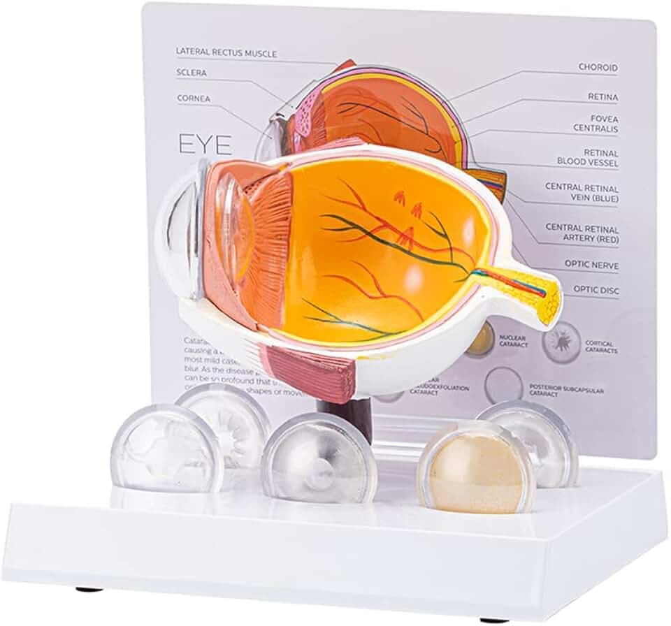 Cornea Augapfel Modell Menschliches Auge Modell Menschliches Auge Demonstration Lehre Requisite Katarakt Anatomie Medizinisches Lehrmodell