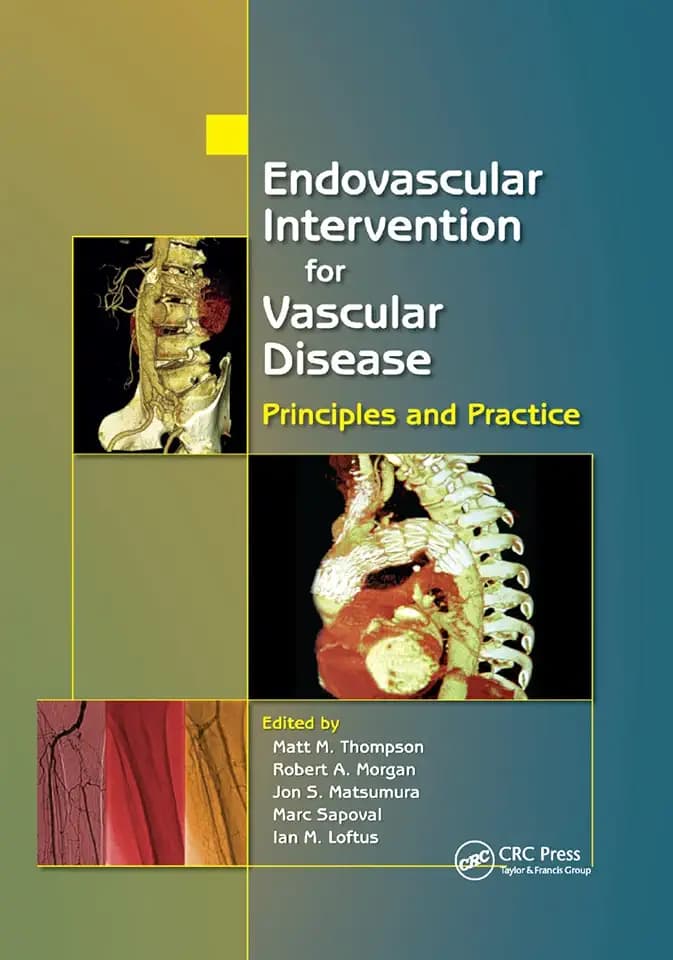 Endovascular Intervention for Vascular Disease: Principles and Practice