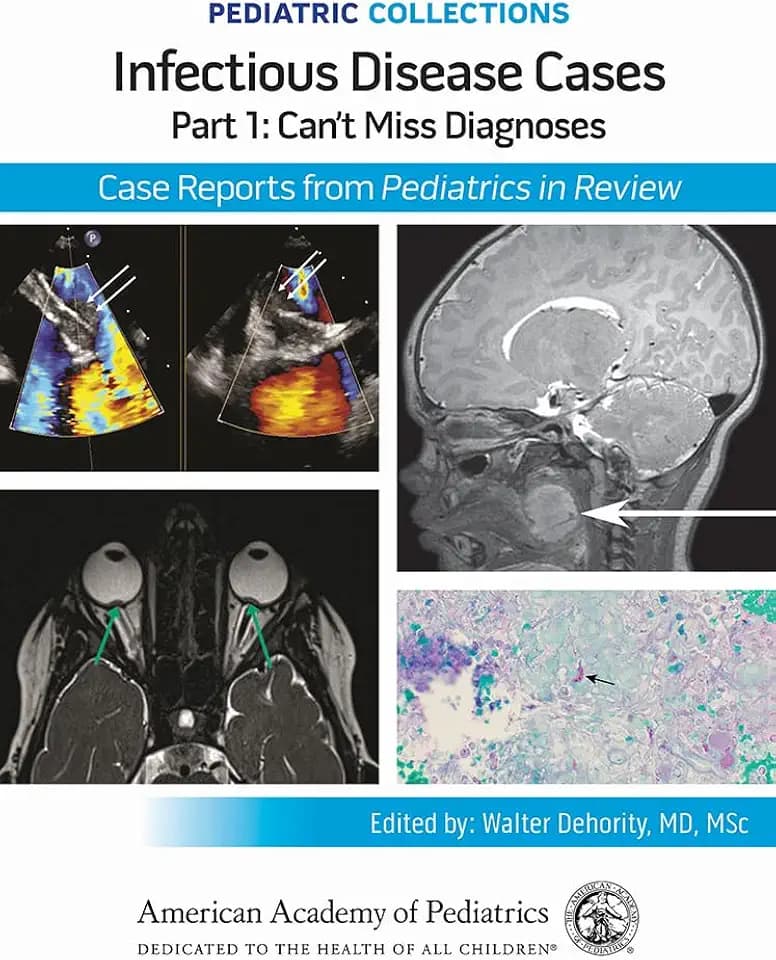 Pediatric Collections: Infectious Disease Cases: Part 1: Can’t Miss Diagnoses: Case Reports from Pediatrics in Review