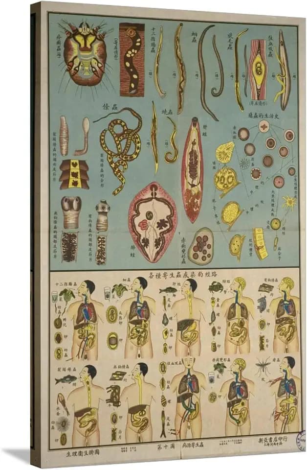 ART.COM Stretched Canvas Print Parasites in the Human Body, 24" x 36"