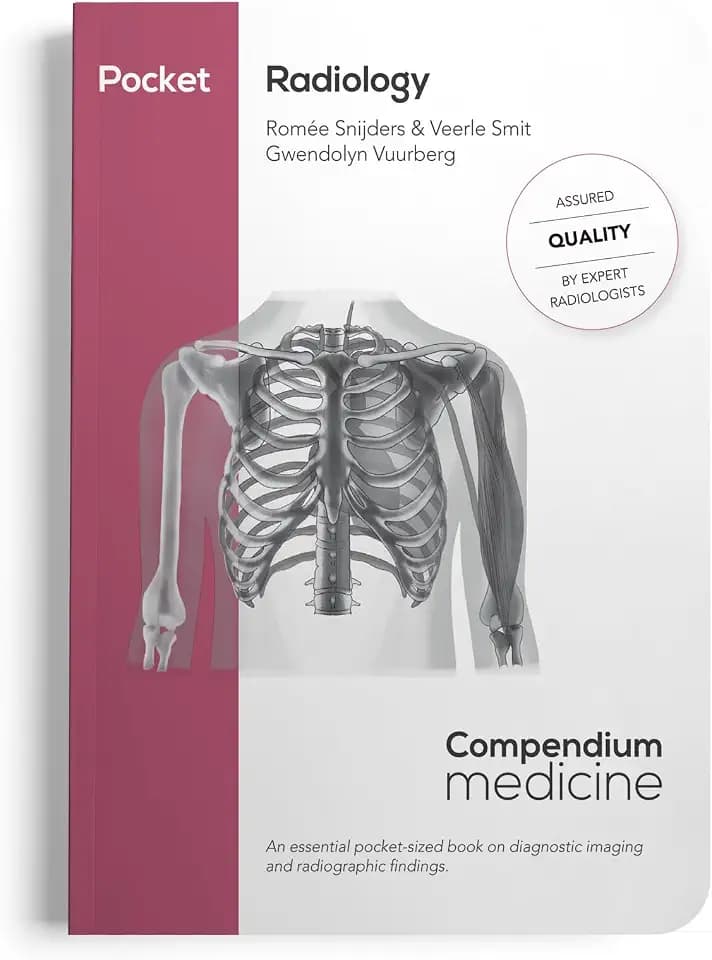Pocket Radiology: An essential pocket-sized book on diagnostic imaging and radiographic findings. (Compendium Medicine)
